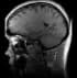 mri